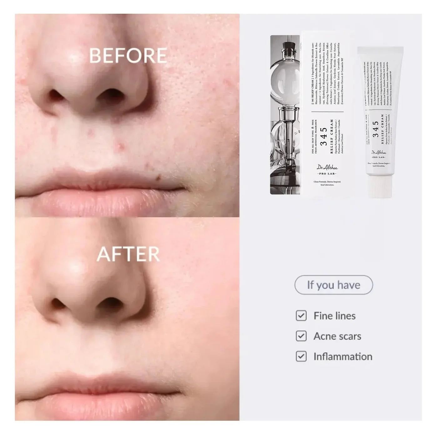 Antes y después con la crema 345 Relief de Dr.Althea